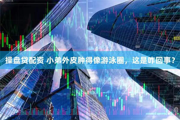 操盘贷配资 小弟外皮肿得像游泳圈，这是咋回事？